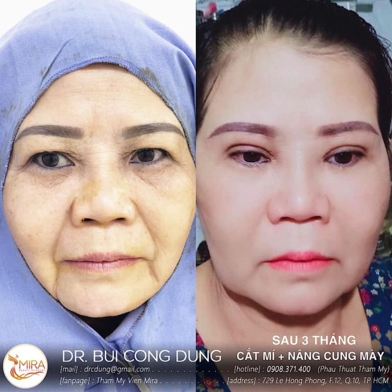 Thẩm mỹ viện MIRA