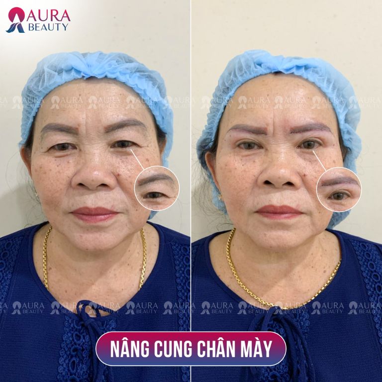 Thẩm Mỹ Viện Quốc Tế Aura