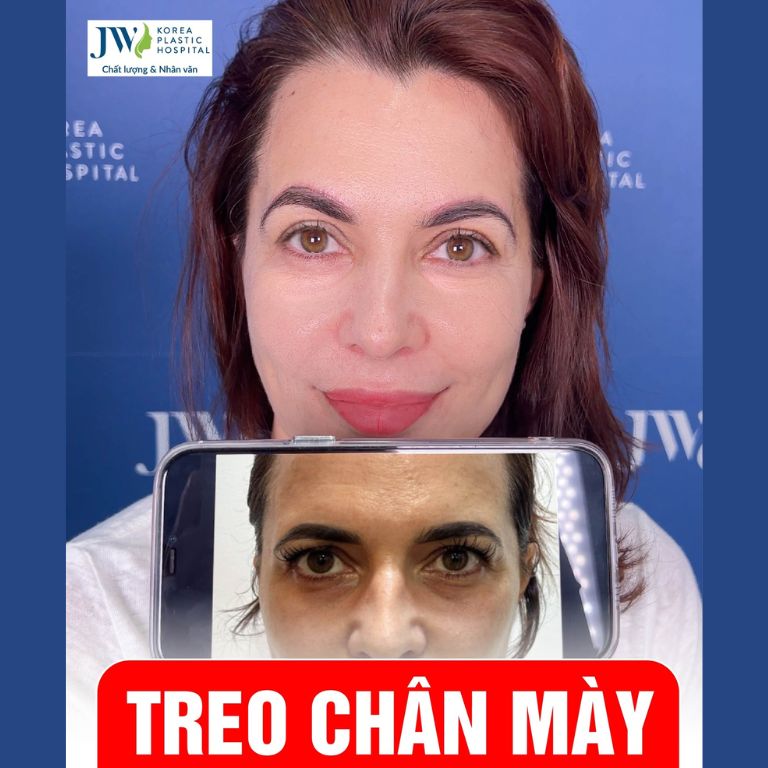 Bệnh viện Thẩm mỹ JW Hàn Quốc