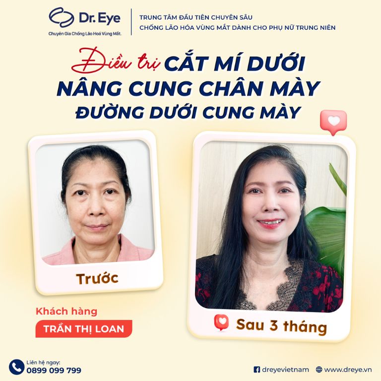 Phòng khám Chuyên khoa Thẩm mỹ Dr. Eye