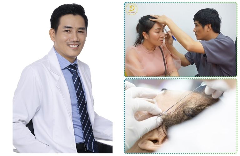 Căng da bằng chỉ Silhouette Soft với bác sĩ Lê Trần Duy