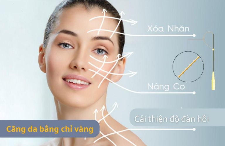 Căng da bằng chỉ vàng