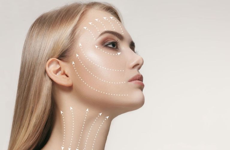 Căng da bằng chỉ vàng là giải pháp tiên tiến, mang đến hiệu quả cao