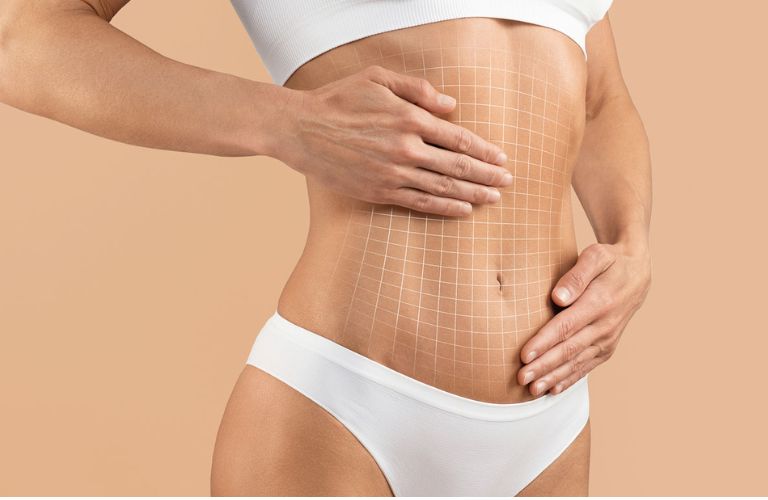 Căng da toàn thân