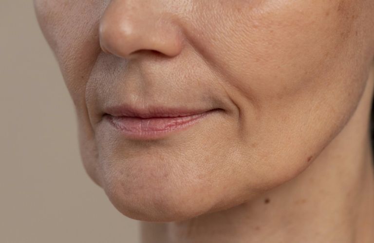 Rãnh cười là hai đường nếp gấp tự nhiên kéo dài từ hai bên cánh mũi xuống khóe miệng