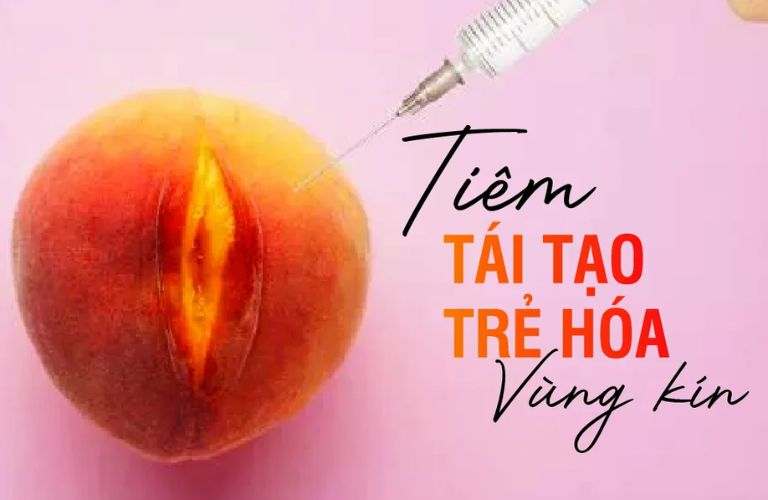 Tiêm Filler vùng kín