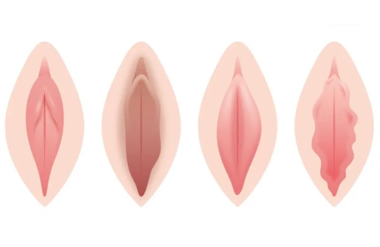 Số lượng cc Filler cần tiêm sẽ tùy thuộc vào tình trạng vùng kín