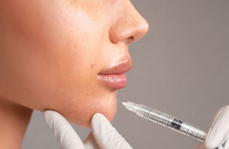 Có thể cân nhắc tiêm bổ sung sau khi vùng điều trị đã ổn định